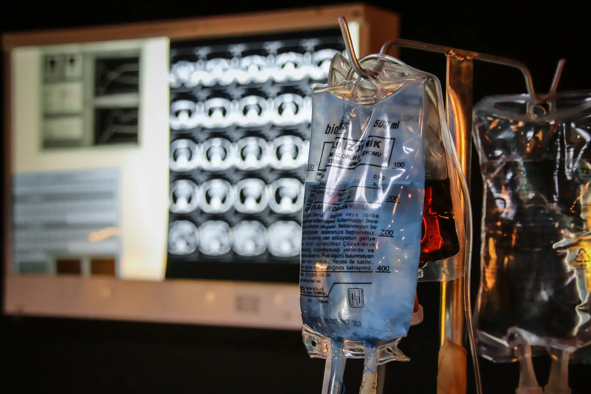 Aerospace Titanium Meets Orthopaedics in Madrid